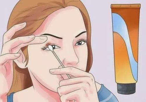 长麦粒肿怎么快速解决,孩子老长麦粒肿怎么回事