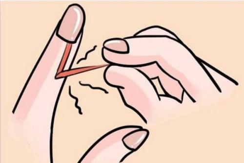 为什么伤口会化脓并且特别难愈合,为什么伤口会化脓还流黄水