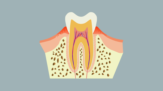 有牙周炎能拔牙吗,牙周炎要拔牙齿吗