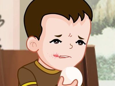 口角炎吃什么好得快,口角炎吃什么好