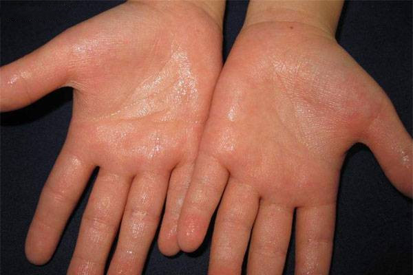 男人冬季手脚出汗是什么原因,冬天手脚老出汗是什么原因