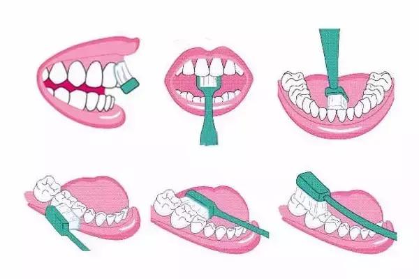 引起牙齿松动的因素有哪些,牙齿松动和什么有关