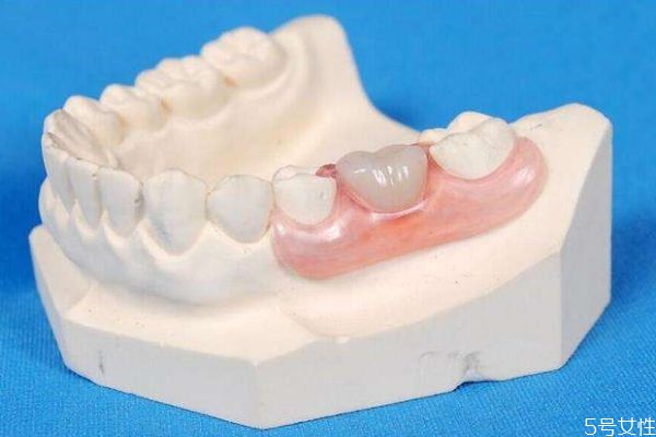 牙缝变大是为什么,牙齿缝变大 牙缝变大是为什么,牙齿缝变大