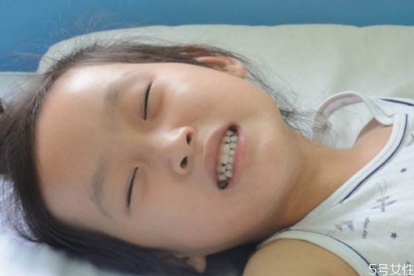 猩红热是什么意思,猩红热是啥 猩红热是什么意思,猩红热是啥