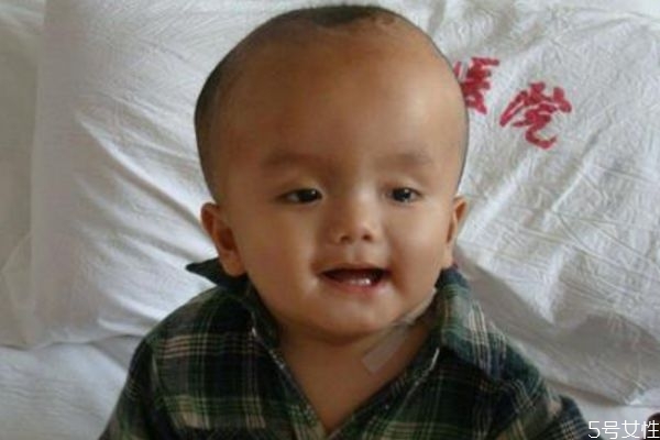 引起脑积水的原因,形成脑积水的原因有哪些? 引起脑积水的原因,形成脑积水的原因有哪些?