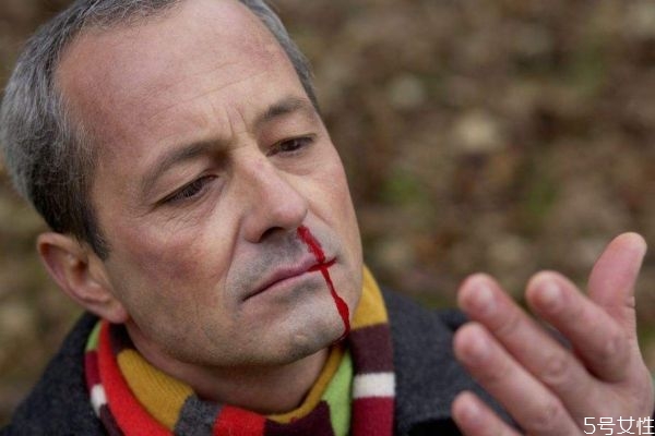 什么叫鼻咽癌,鼻咽癌是什么癌 什么叫鼻咽癌,鼻咽癌是什么癌