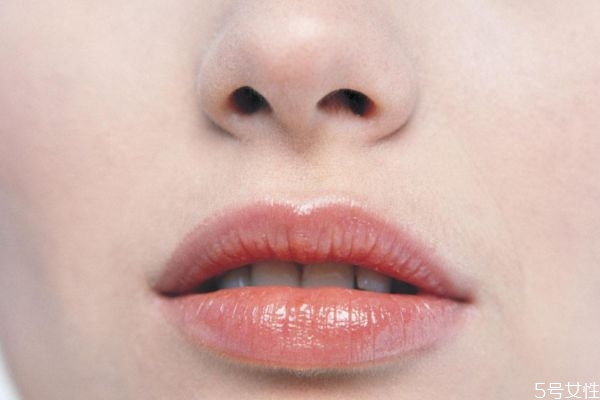 唇炎是怎么导致的,唇炎是什么原因造成的