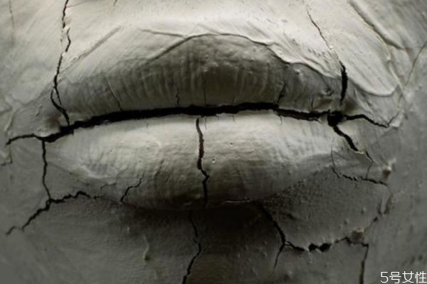 什么是唇炎呢,什么叫唇炎?