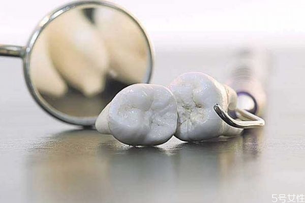 年轻人牙齿松动怎么治最好的办法,青年人牙齿松动怎么办