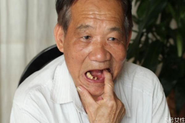 为啥冰糖葫芦会粘牙,吃了冰糖葫芦不能吃什么