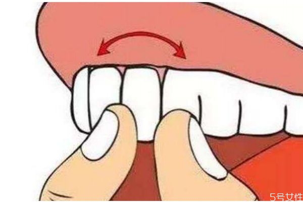 牙齿松动很疼怎么办,牙齿松动疼怎么回事