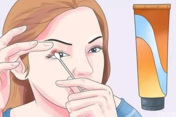 什么是麦粒肿图片,麦粒肿是什么原因引起的?