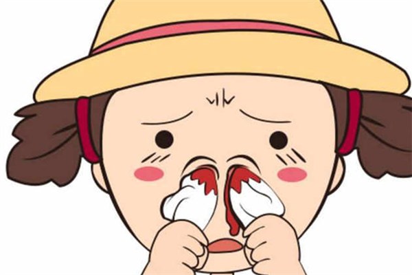 为什么会流鼻血什么原因引起的,什么原因会引起流鼻血
