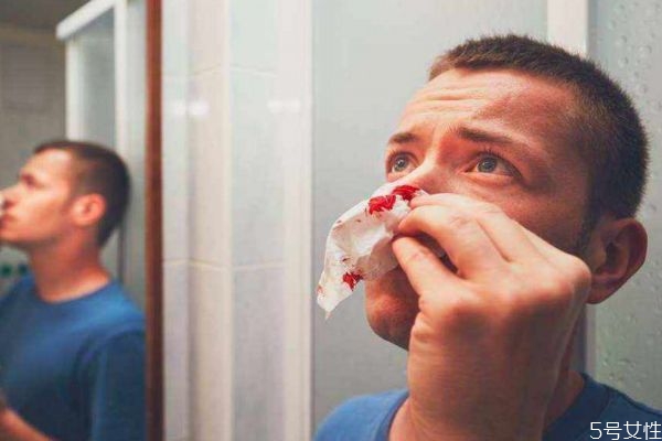 鼻子出血要怎么办,鼻子出血怎样处理