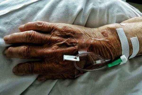 手血管明显是什么原因,手上血管突出是怎么回事怎么解决 手血管明显是什么原因,手上血管突出是怎么回事怎么解决