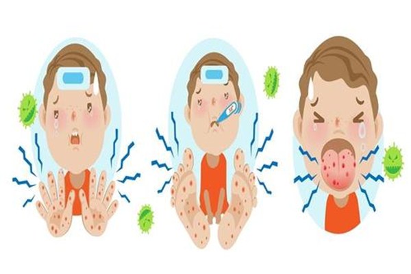 手足口病第几天传染性最强,小孩手足口病第几天最严重