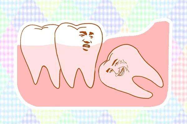 牙齿矫正一定要拔智齿吗,智齿一定要拔吗?