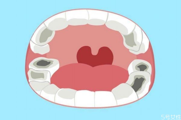 什么的虫牙,什么叫虫牙