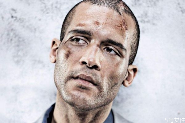 科塔尔综合症的特点,科塔尔综合症