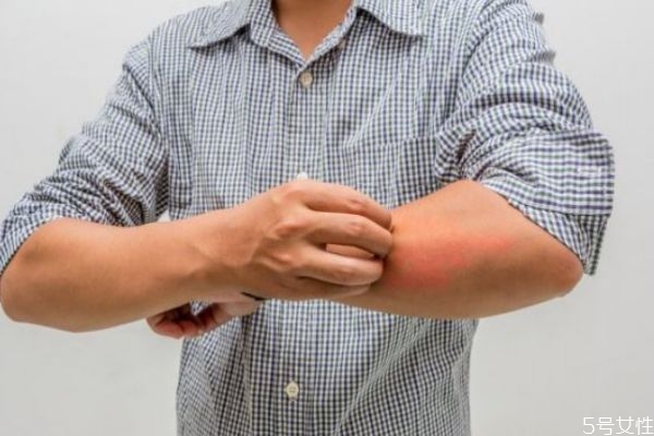 唾液可以传染艾滋病吗?,艾滋病人唾液能传染吗