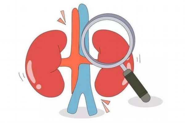 肾结石要注意什么,肾结石注意哪些饮食方面的问题