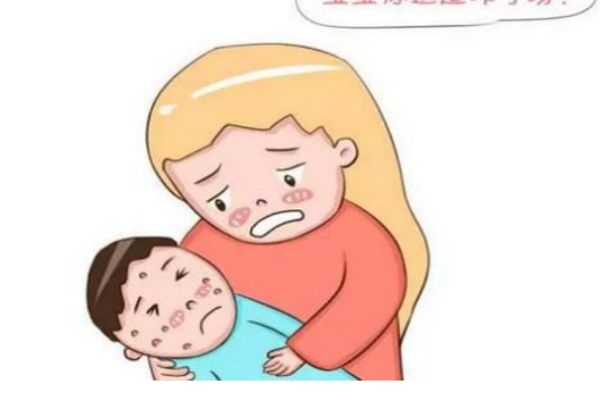 怎么知道是不是得了水痘,怎样确诊是不是得了水痘了 怎么知道是不是得了水痘,怎样确诊是不是得了水痘了