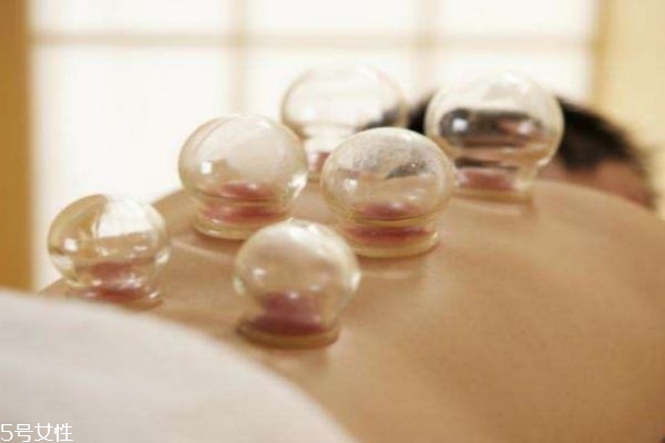 拔罐有什么好处呢,拔罐有什么好处和坏处 拔罐有什么好处呢,拔罐有什么好处和坏处