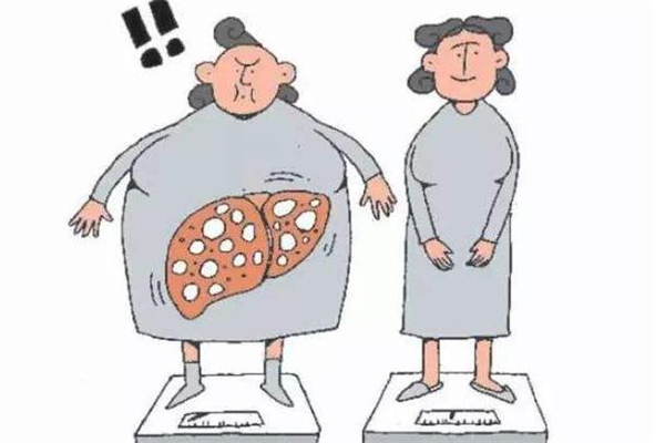 跑步能降低脂肪肝吗?,重度脂肪肝跑步有用吗 跑步能降低脂肪肝吗?,重度脂肪肝跑步有用吗