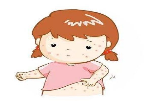 皮肤湿疹是什么样的,什么是湿疹?