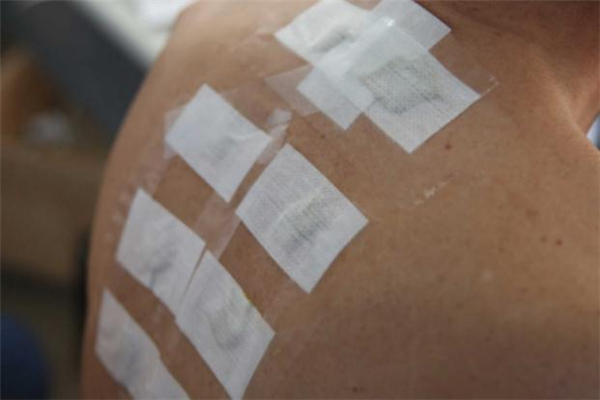 来月经可以贴三伏贴吗,月经量少可以贴三伏贴吗