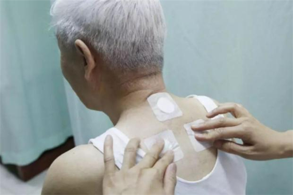 三伏贴平时可以贴吗?,三伏天过后还能贴三伏贴吗