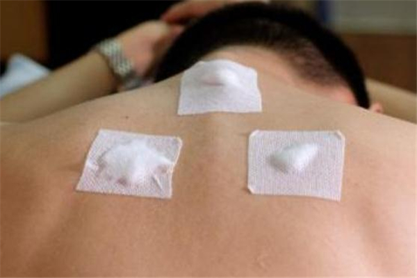 不知道怀孕贴了三伏贴,三伏天过后还能贴三伏贴吗