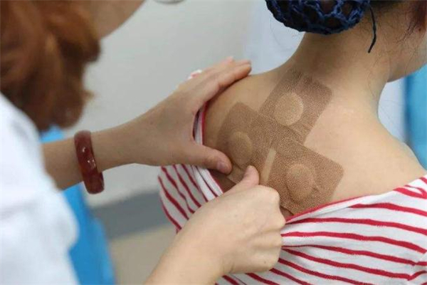 贴三伏贴为什么要忌口3天,三伏贴有什么禁忌吗