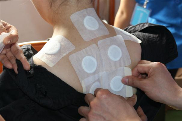 三伏贴 妇科,三伏贴治疗什么病效果好