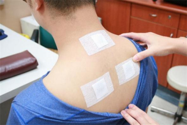 三伏贴在哪里可以买到,三伏贴贴哪里