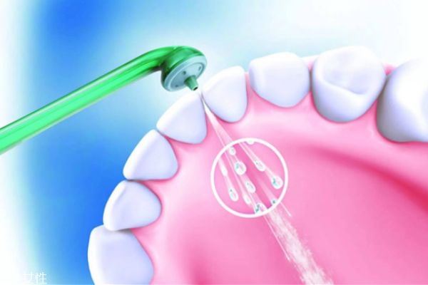 牙结石一定要清除吗,牙齿结石要不要去洗 牙结石一定要清除吗,牙齿结石要不要去洗