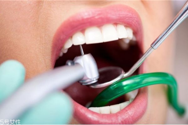 医院去牙结石多少钱,牙结石清理多少钱