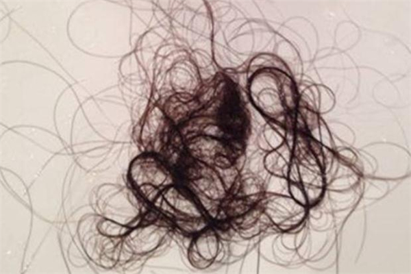 头发属于什么垃圾分类,掉的头发属于什么垃圾