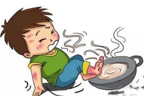 烫伤的水泡可以挑破吗,烫伤后的水泡能挑破吗大于1cm 烫伤的水泡可以挑破吗,烫伤后的水泡能挑破吗大于1cm