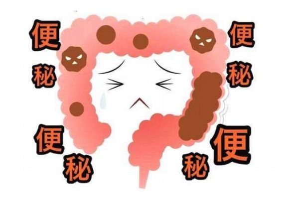 便秘了怎么办简单方法,便秘的治疗方法有哪些?