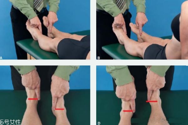 对于长短脚如何自行治疗,长短脚如何矫正