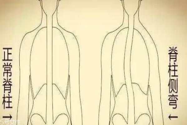 长短腿会导致什么问题,高低肩长短腿是什么引起的