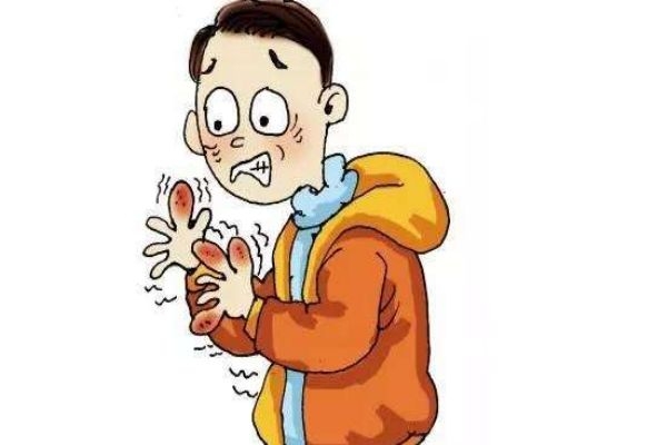 手上冻疮怎么快速止痒,手上冻疮痒怎么缓解