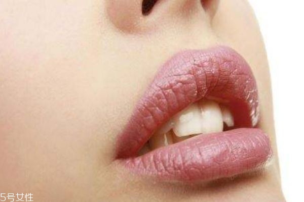 嘴巴上反复长疱疹是怎么回事,嘴皮上长了疱疹怎么办 嘴巴上反复长疱疹是怎么回事,嘴皮上长了疱疹怎么办