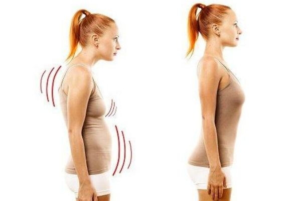 驼背是遗传吗,驼背是遗传病吗 驼背是遗传吗,驼背是遗传病吗