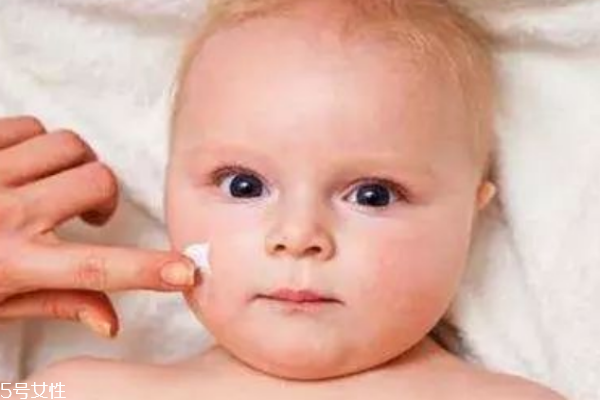 宝宝脸上长了很多湿疹怎么办,宝宝湿疹怎么处理最好办法