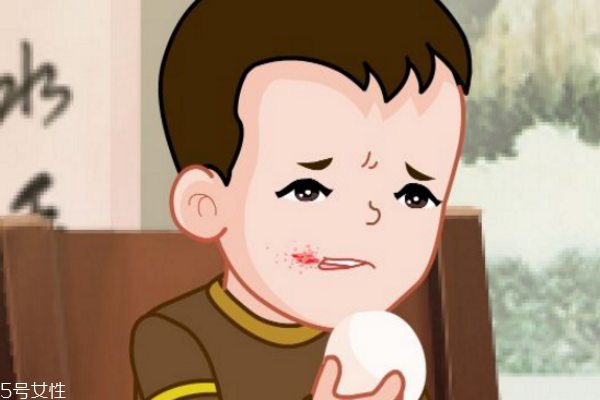 口唇炎是缺乏什么维生素,口腔溃疡是缺乏什么维生素