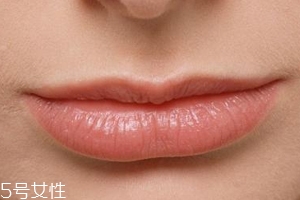 什么病引起嘴唇干裂,嘴唇干裂是什么毛病