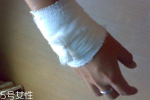 被蜈蚣咬了不治疗有事吗,被蜈蚣咬伤了如果长期不去治疗会怎么样