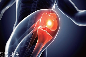 膝骨关节炎有什么好的办法治疗,膝关节炎的症状 膝骨关节炎有什么好的办法治疗,膝关节炎的症状